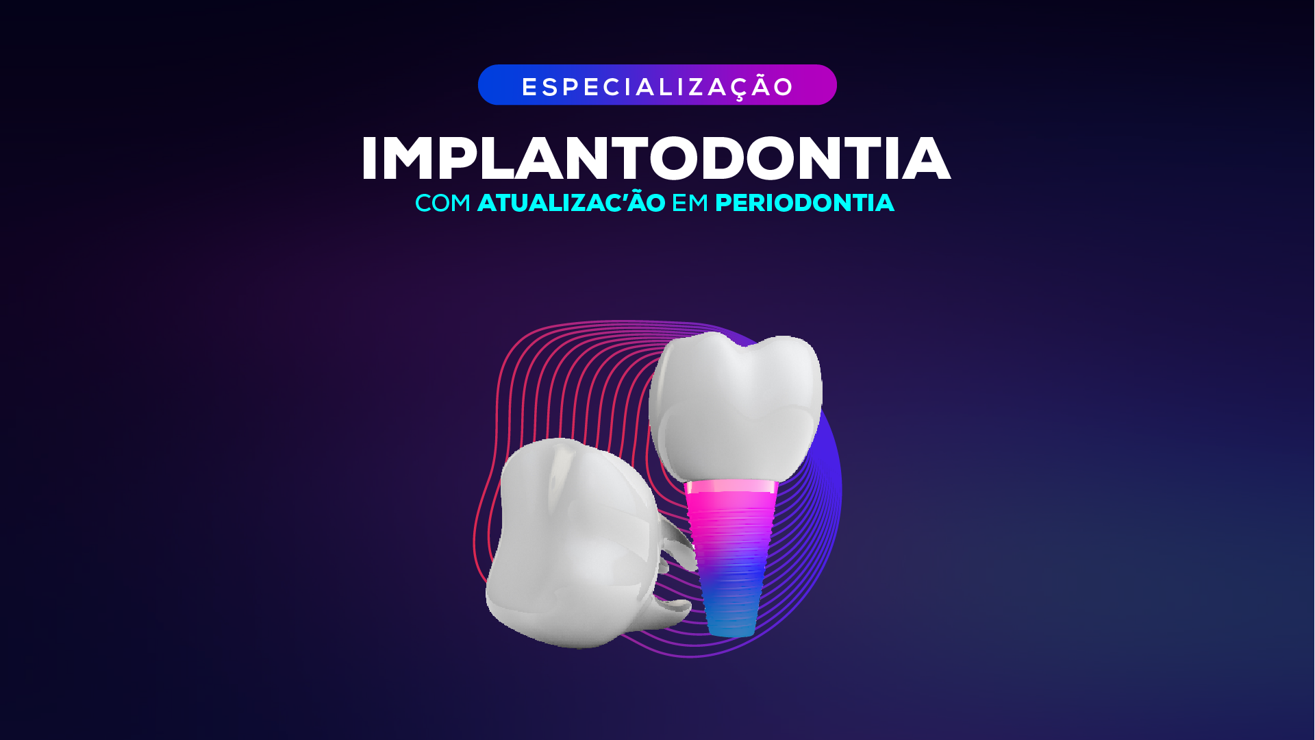 ioa_site_capas_cursos_implanto